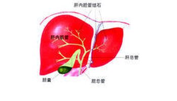 胆囊分底,体,颈,管四部,颈部连胆囊管.