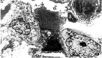 2μm,核部略厚,基底部是基底膜,表面光滑,核扁圆形,光学显微镜下难以
