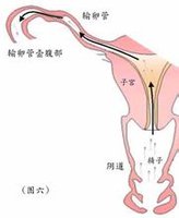 若受精卵未能移入子宫而在输卵管内发育,则为输卵管妊娠.