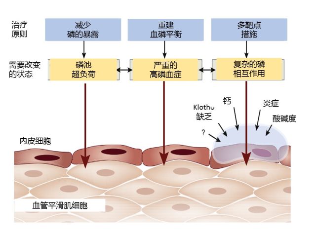 3 图读懂慢性肾脏病患者「高磷血症」的危害与治疗