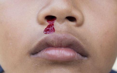 儿童为什么会流鼻血 有6种起因