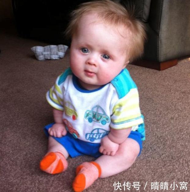 3岁宝宝患罕见病,只能穿半岁小孩衣服,走路就