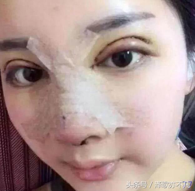 万想整成迪丽热巴,纱布揭开,这不就是李溪芮!