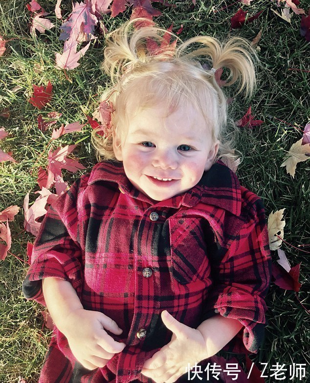 18月大女婴水过敏,母亲从不准她哭,泪水、汗液