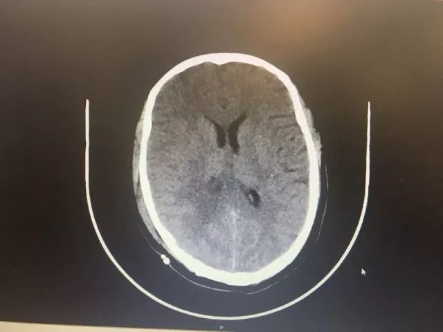 只要开 就是瘫?他们两个半小时成功\"拆弹\" 实力给出回答