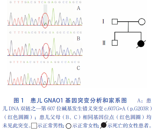 反复抽搐、肺部感染并发育落后的早发型癫癎脑病