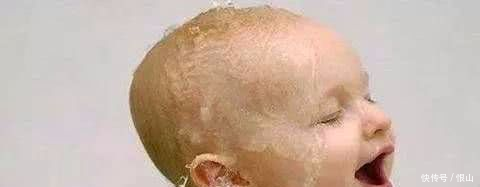 宝宝出汗多,是体虚还是缺钙