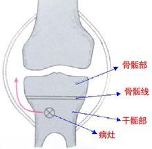 骨骺的骺读什么?什么意思?(写出拼音)