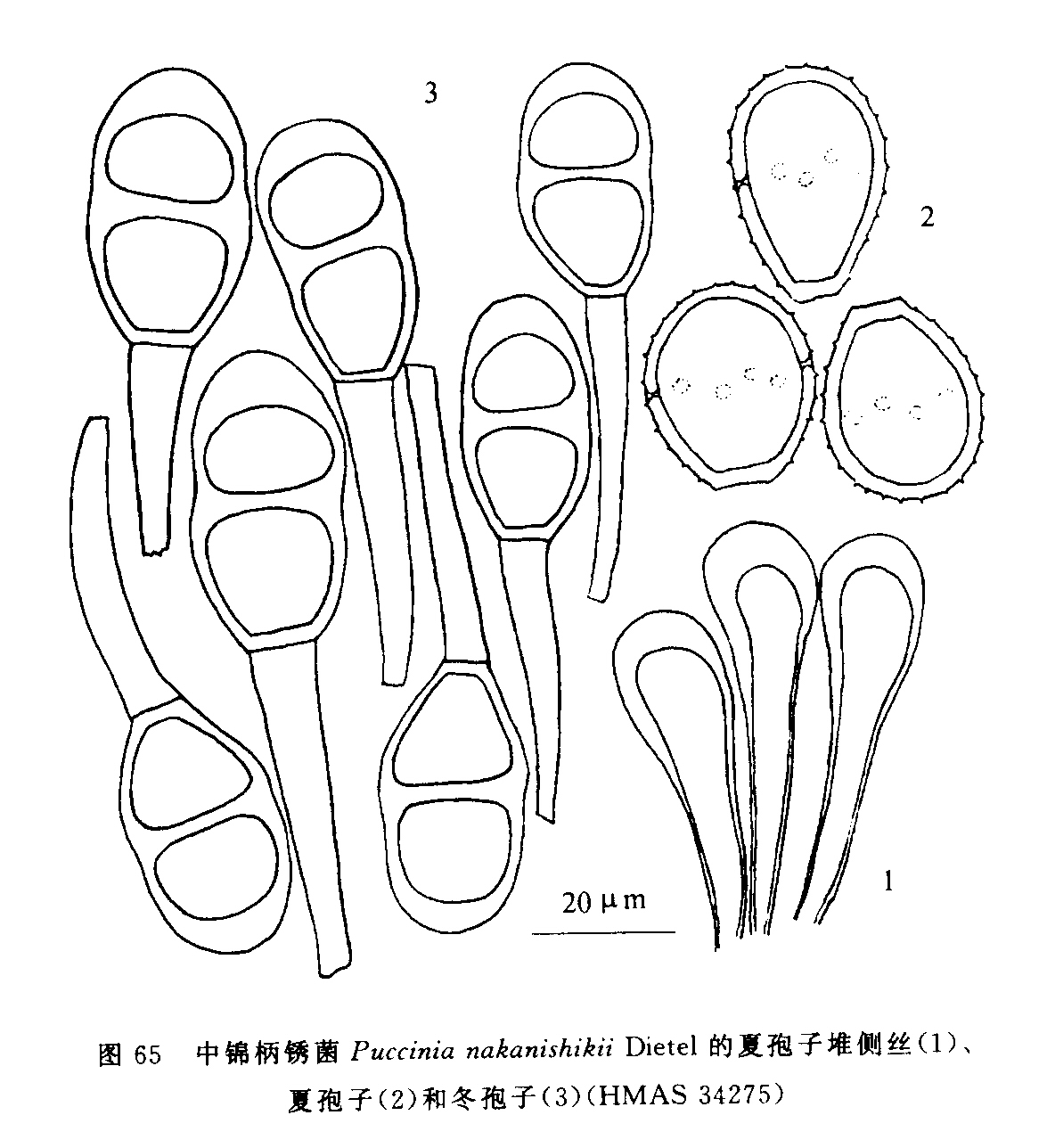 中锦柄锈菌