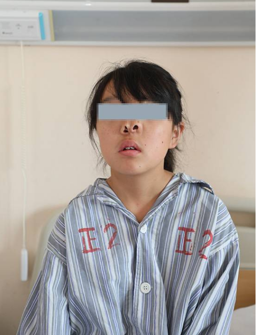少女长三鼻孔无法正常呼吸,16年后来到上海,只