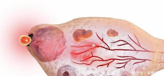 受精卵着床需要几天身体的这3个变化暗示你