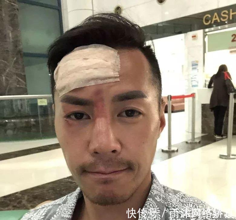前香港先生出海撞爆额头流血不止 坦言内疚令