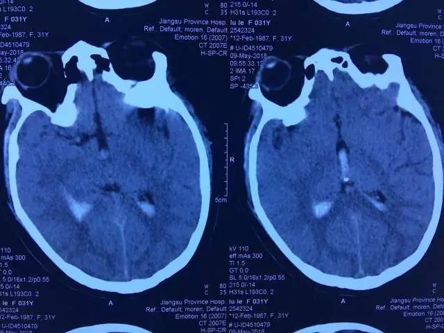 只要开 就是瘫?他们两个半小时成功\＂拆弹\＂ 实力给出回答