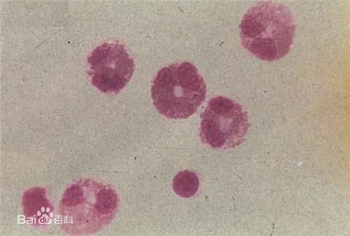 嗜酸粒细胞和嗜酸乳杆菌的区别是什么?_360问