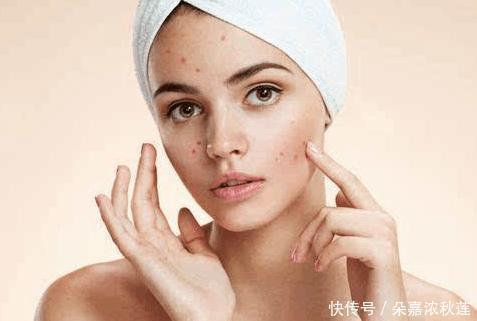 修复激素依赖性皮炎过程中起疹子怎么办? 可以