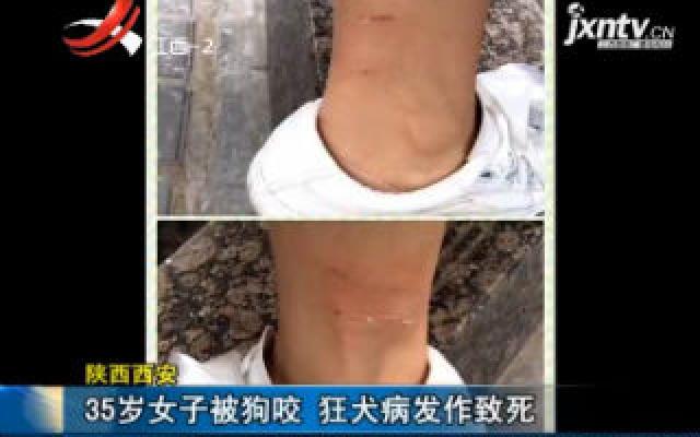 陕西西安:35岁女子被狗咬 狂犬病发作致死