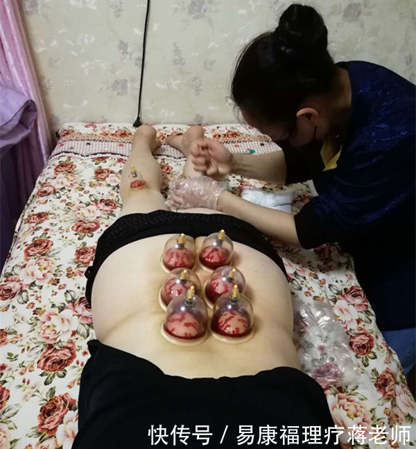 腰背疼痛的中医针刺、艾灸、火罐疗法