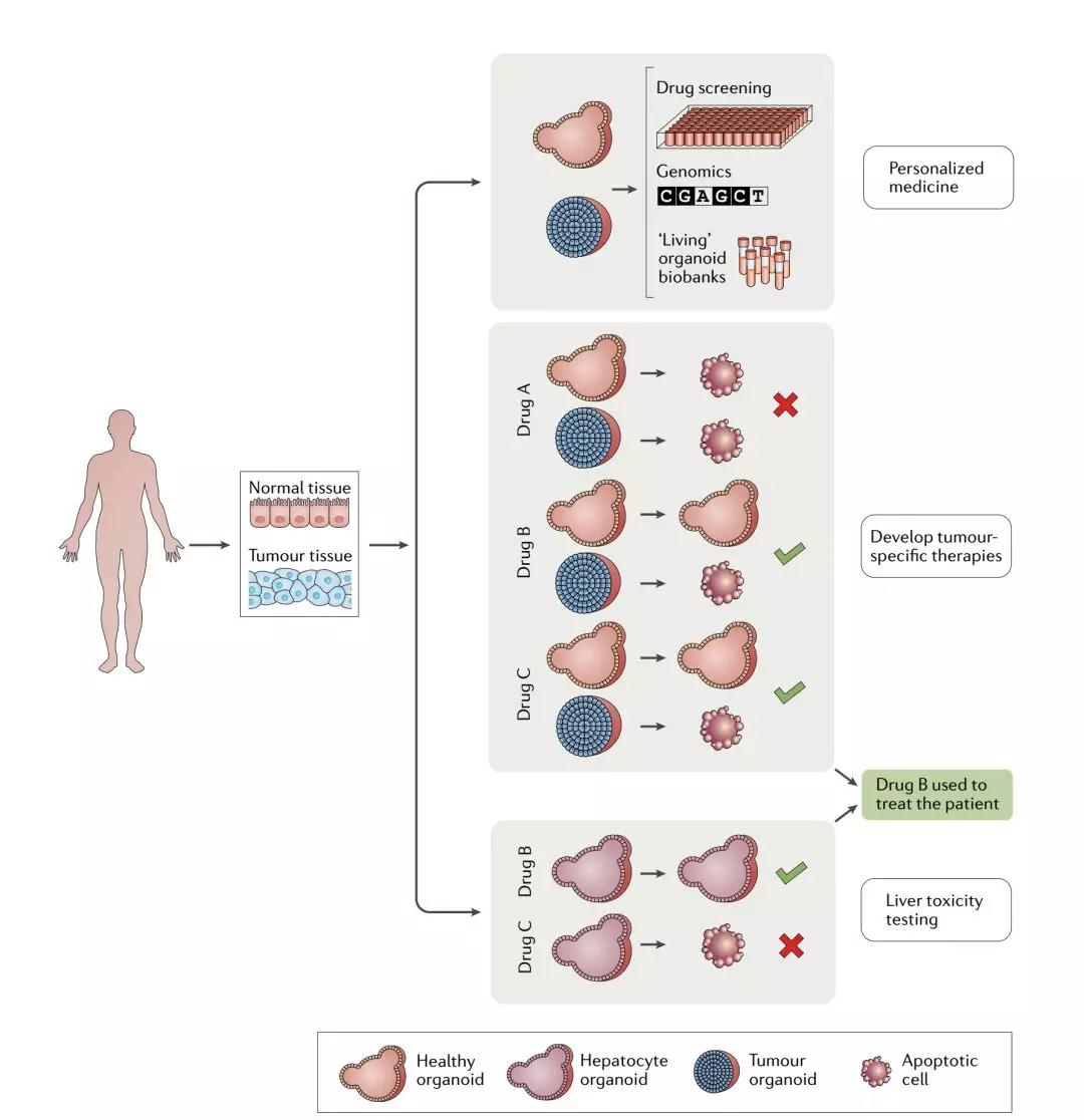 Nature综述:抗癌药研发新平台--类器官
