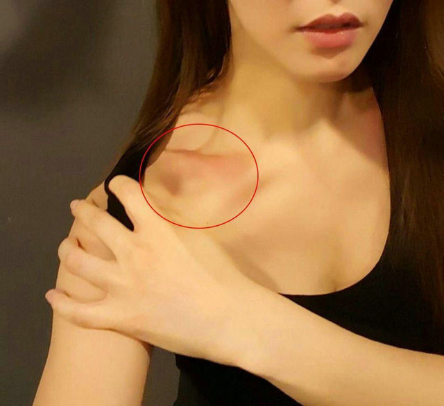 韩健身女神为翘臀狂举杠铃 锁骨受伤惹人怜