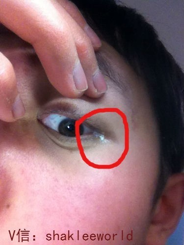 现在发现一只眼睛眼角有白色分泌物出来,是不