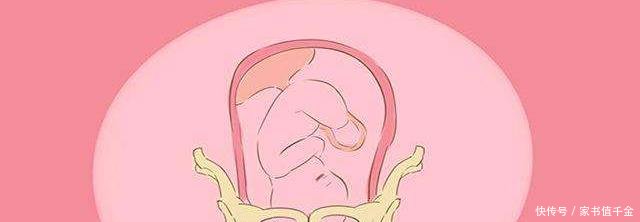 孕晚期,胎儿的入盆时间早晚,和哪些情况有关看