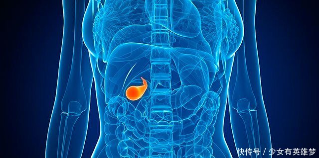 胆囊炎是不是一定并发胆结石呢?