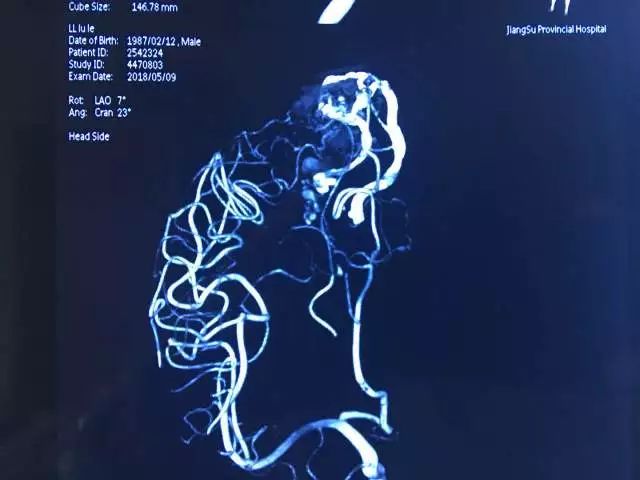 只要开 就是瘫?他们两个半小时成功\＂拆弹\＂ 实力给出回答