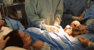 医生为孕妇剖腹后让婴儿自己爬出母体 - 谭笑古今 - 谭笑古今 医生为孕妇剖腹后让婴儿自己爬出母体 - 谭笑古今 - 谭笑古今