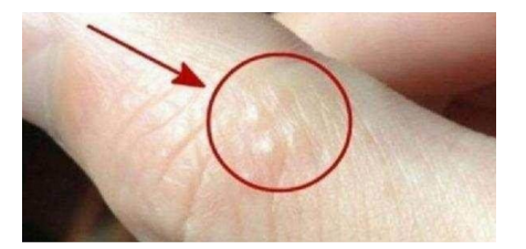 当你手上有这几种症状时，快点去医院看病，别怪老中医没提醒你，