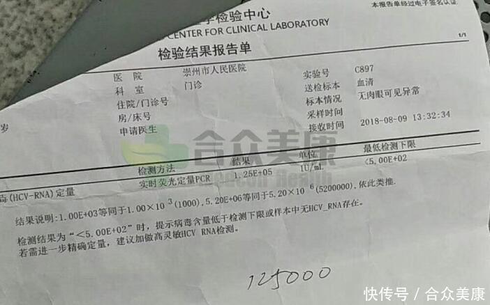 四川46岁丙肝患者通过合众美康买吉三代治愈