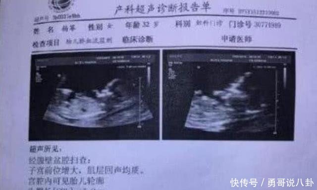 杨幂二胎预产期遭曝光,刘恺威借此征求宝宝名