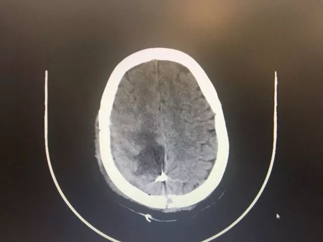 只要开 就是瘫?他们两个半小时成功\"拆弹\" 实力给出回答