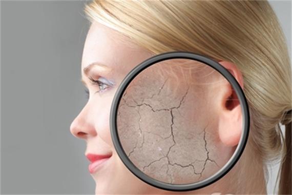 脸皮肤缺水过敏了怎么办