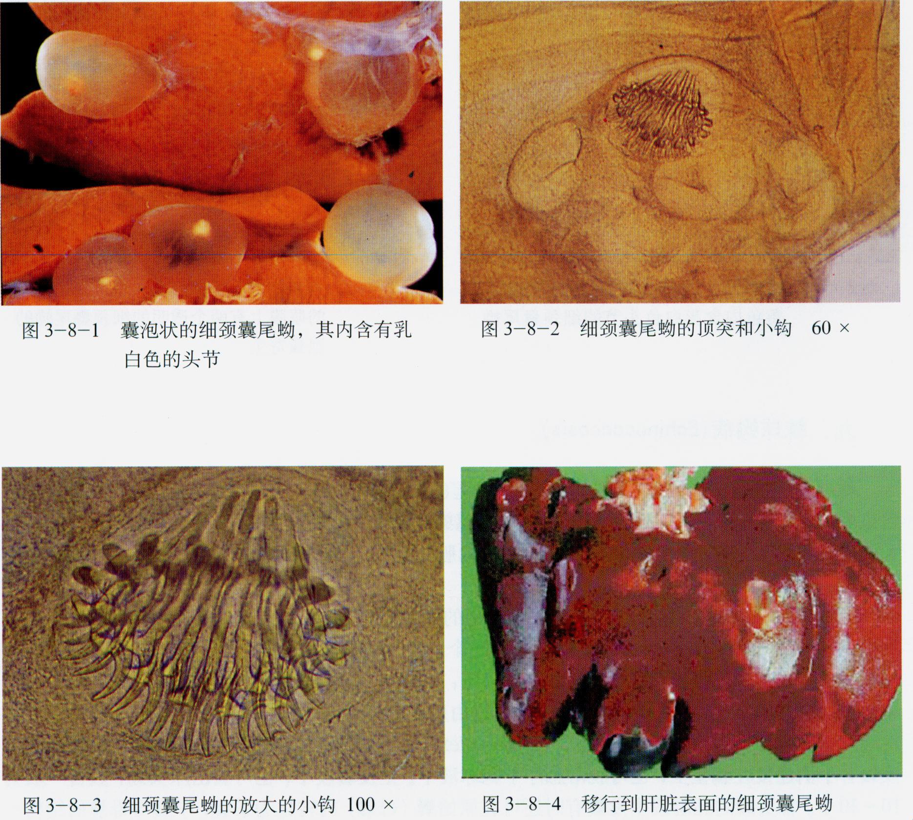 概述 细颈囊尾蚴病是由带科泡状带绦虫的幼虫阶段—— 细颈囊尾蚴所