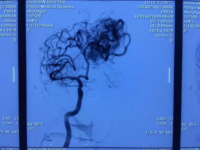 只要开 就是瘫?他们两个半小时成功\＂拆弹\＂ 实力给出回答