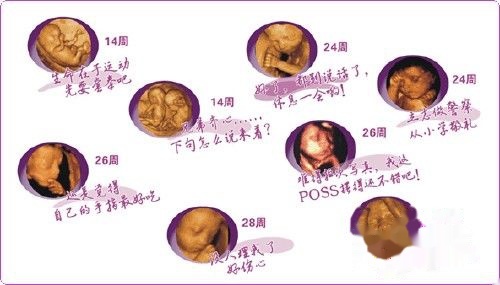 怀孕几个月可以做四维彩超 t017b515f11ae633497.jpg
