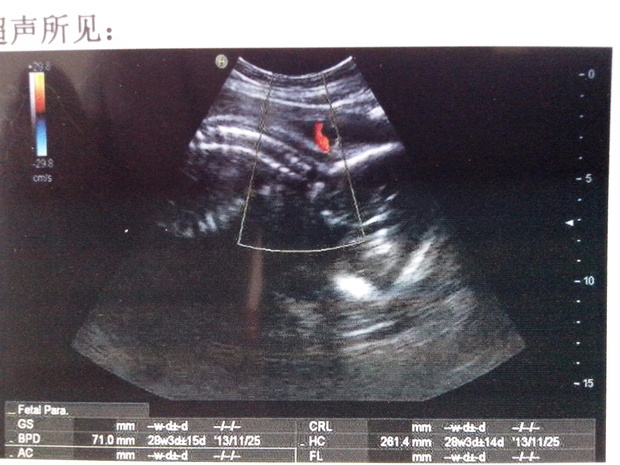 能看出<em>男孩女孩</em>吗?