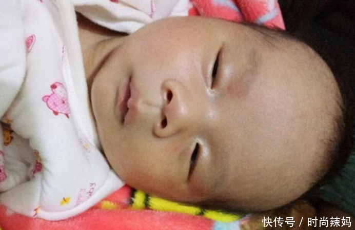 以下5种疾病只遗传男不传女,婴儿一旦患上此病,将一生难以治愈
