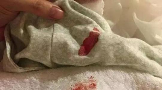 12岁男孩突然下身出血 医生告知检查结果 母亲