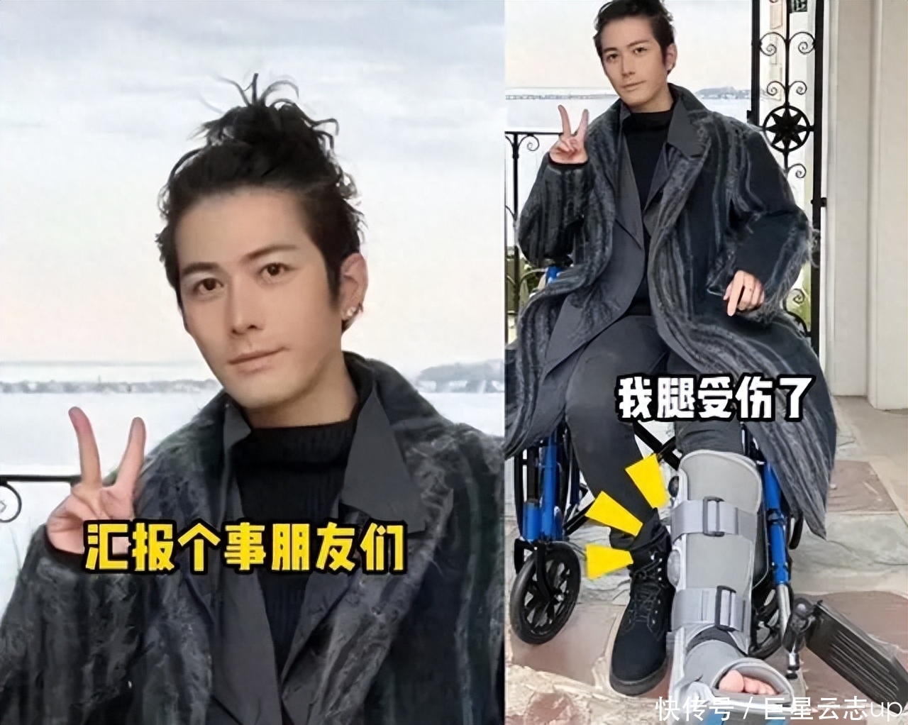 病床车怎么画陈学冬车祸受伤第三次手术,静躺病床满腿伤疤,头发全白模样憔悴_新闻资讯_第6张_活检穿刺产品网 病床车怎么画陈学冬车祸受伤第三次手术,静躺病床满腿伤疤,头发全白模样憔悴_https://www.jmylbn.com_新闻资讯_第6张