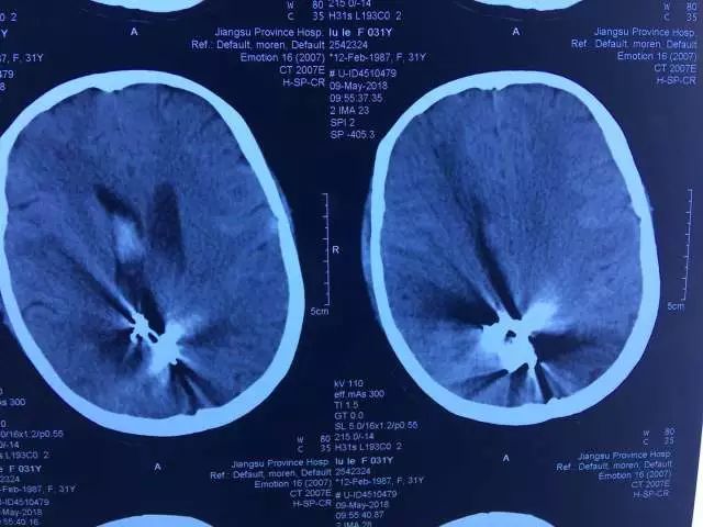 只要开 就是瘫?他们两个半小时成功\＂拆弹\＂ 实力给出回答