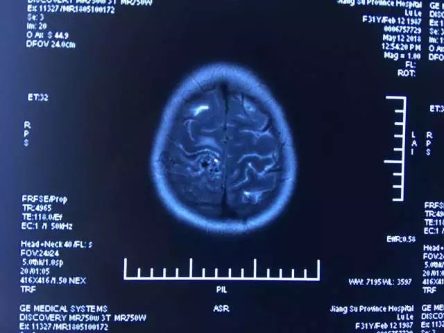 只要开 就是瘫?他们两个半小时成功\＂拆弹\＂ 实力给出回答