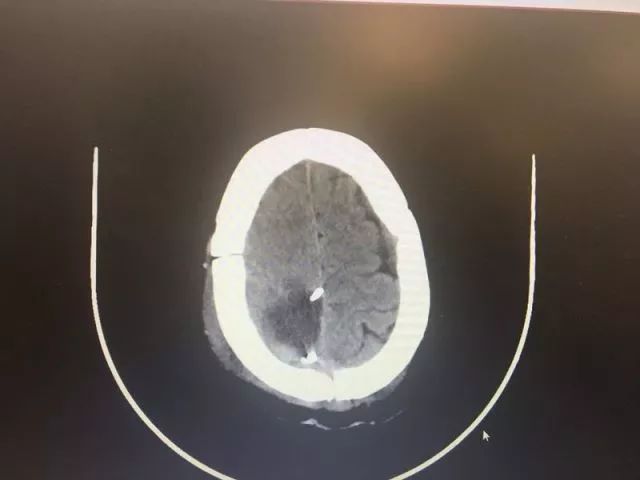只要开 就是瘫?他们两个半小时成功\"拆弹\" 实力给出回答