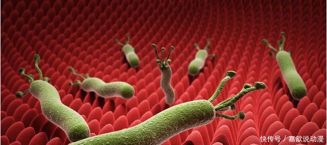 幽门螺旋杆菌如何复查医生推荐2种检查法,轻松