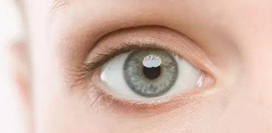 色盲测试题若你看出这是一头鹿,证明你是色盲