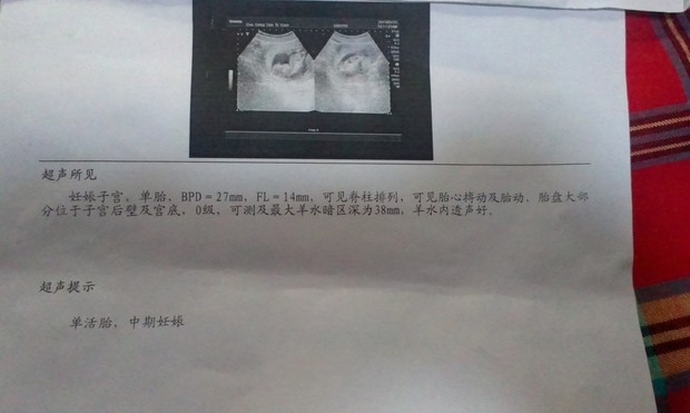 媳妇<em>怀孕</em>块4个月啦,老想<em>知道</em>是<em>男孩</em>还是<em>女孩</em>