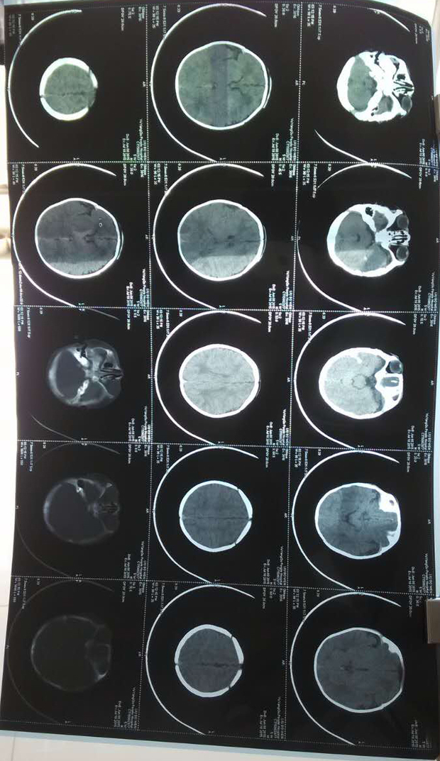 求助:拿脑ct 图像找医生,要给500钱才给看,唉,哪位真正的白衣天使帮我