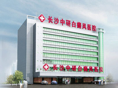 长沙中研白癜风医院可靠吗?收费正规合理透明