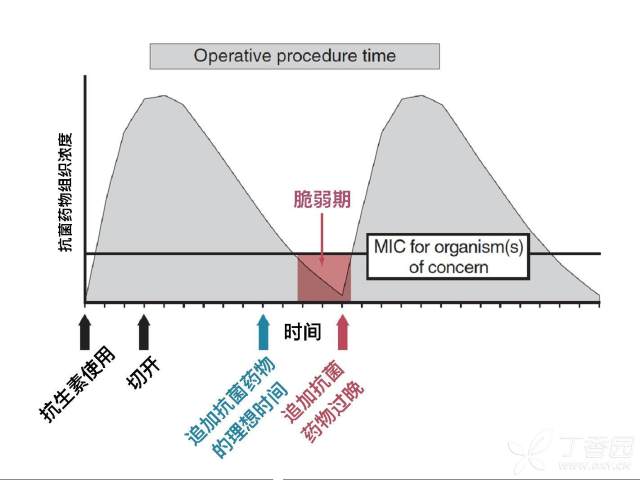 剖宫产围手术期预防用抗菌药物