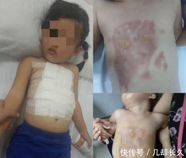 3岁女童在餐厅被开水烫伤,家长索赔!餐厅却称其母亲当时在“玩手机”… 盈丰平台